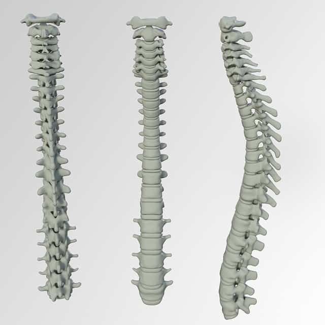 Spinal Injury Claims Spinal Injury Claims
